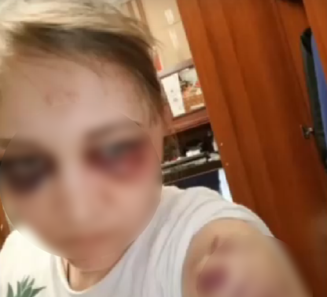 «Бери 40 тысяч, а не возьмешь – опять побьем»: напавший на русских женщин Ариф пытался откупиться деньгами, но его уже ждали.